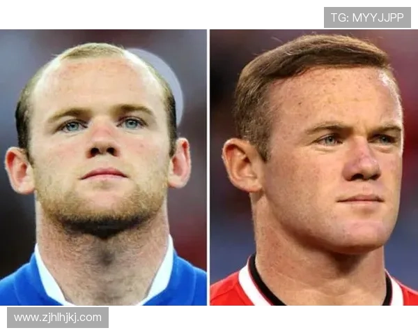 足球球星秃头现象：从外貌变化到心理挑战的全方位分析